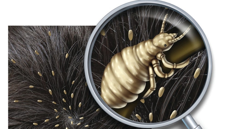 Lice are not known to spread to pets, but they can live on a couch for up to two days.